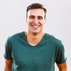 Adult braces put on by chomp orthodontics in san fernando valley